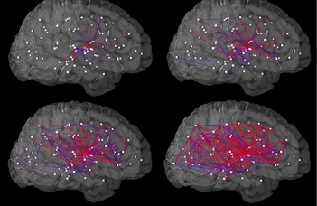 Komoly előrelépést tettek az agykutatás terén az ELTE kutatói