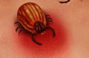 A Lyme-kór diagnózisáról és kezeléséről