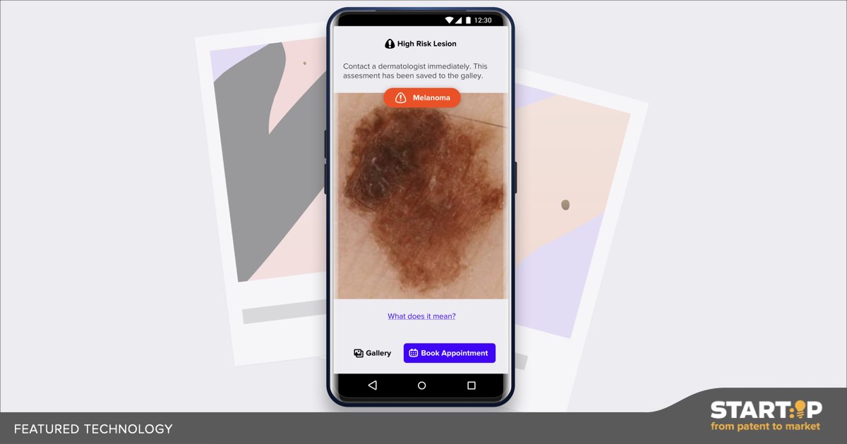 Ingyenes Melanoma Szres